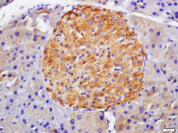 GLP-1R Rabbit Polyclonal Antibody