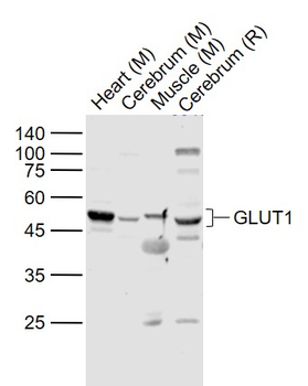 GLUT1 Rabbit Polyclonal Antibody
