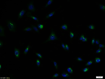 GLUT4 Rabbit Polyclonal Antibody