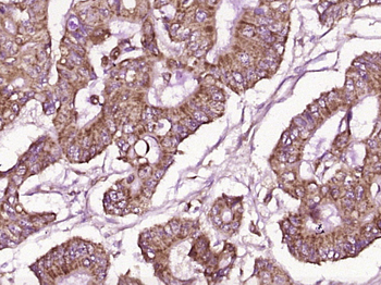 GPA33 Rabbit Polyclonal Antibody