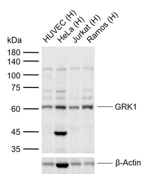 GRK1 Rabbit Polyclonal Antibody