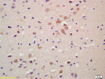 GRK1 Rabbit Polyclonal Antibody