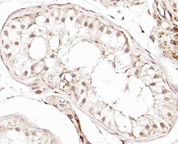 GRP75 Rabbit Polyclonal Antibody