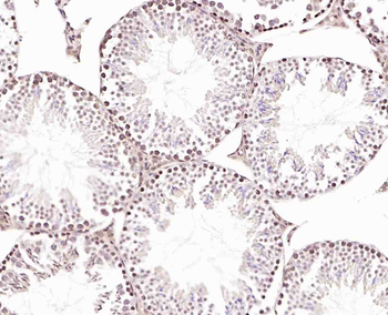 GRP75 Rabbit Polyclonal Antibody