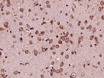 GRP94 Rabbit Polyclonal Antibody