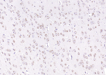 GRP94 Rabbit Polyclonal Antibody