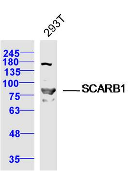 SCARB1/Scavenger Receptor BI Rabbit Polyclonal Antibody