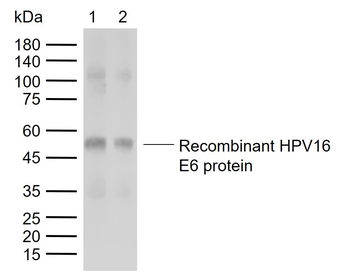 HPV16 E6 + HPV18 E6 Rabbit Polyclonal Antibody