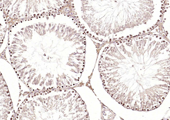 HSTF2 Rabbit Polyclonal Antibody