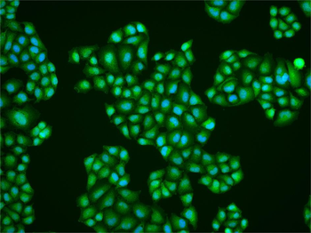 HSTF2 Rabbit Polyclonal Antibody