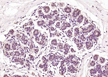 HSPB6 Rabbit Polyclonal Antibody