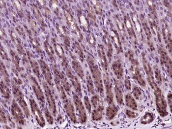 HSP27 Rabbit Polyclonal Antibody