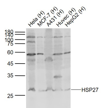 HSP27 Rabbit Polyclonal Antibody
