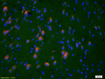 HSP27 Rabbit Polyclonal Antibody