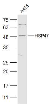 HSP47 Rabbit Polyclonal Antibody