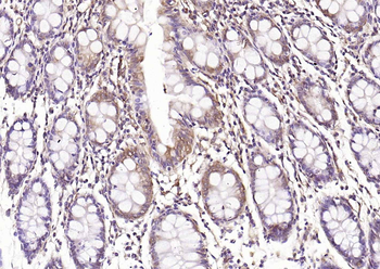 HSP47 Rabbit Polyclonal Antibody