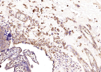 HSP47 Rabbit Polyclonal Antibody