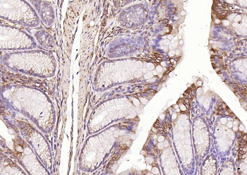 HSP47 Rabbit Polyclonal Antibody