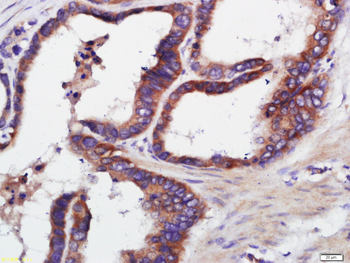 TERT Rabbit Polyclonal Antibody