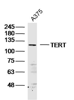 TERT Rabbit Polyclonal Antibody