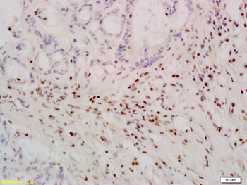 TERT Rabbit Polyclonal Antibody