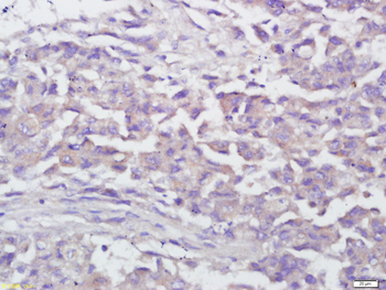 IFN gamma (F2E4) Mouse Monoclonal Antibody