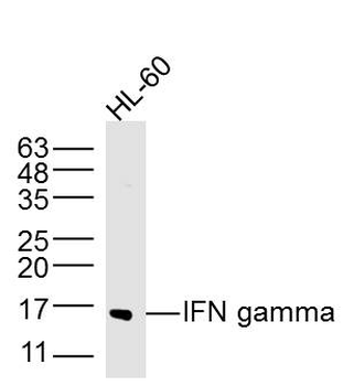 IFN gamma Rabbit Polyclonal Antibody