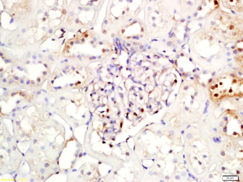 IKB alpha Rabbit Polyclonal Antibody