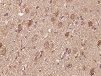 IL12A Rabbit Polyclonal Antibody