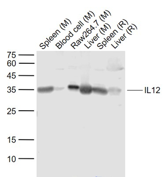 IL12A Rabbit Polyclonal Antibody