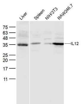 IL12A Rabbit Polyclonal Antibody