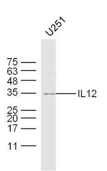 IL12A Rabbit Polyclonal Antibody
