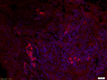 IL12A Rabbit Polyclonal Antibody