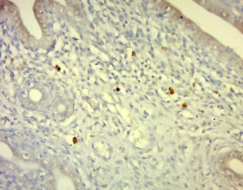 IL18 Rabbit Polyclonal Antibody