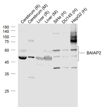 BAIAP2 Rabbit Polyclonal Antibody