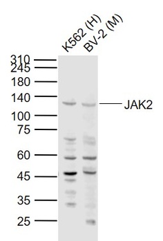 JAK2 antibody