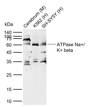 ATP1B2 Rabbit Polyclonal Antibody