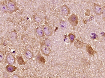 KISS1 Rabbit Polyclonal Antibody