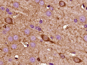KISS1 Rabbit Polyclonal Antibody