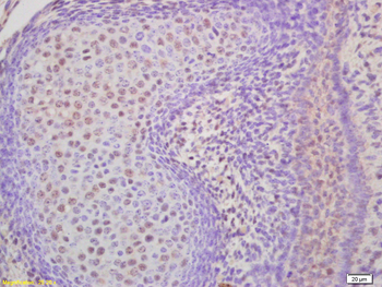 Phospho-KLF5 (Ser272) Rabbit Polyclonal Antibody