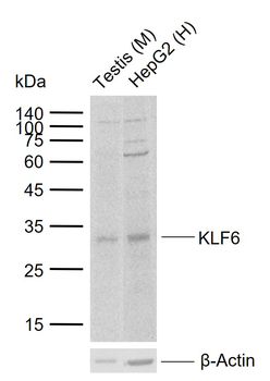 KLF6 Rabbit Polyclonal Antibody