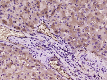 Ox-LDL Rabbit Polyclonal Antibody