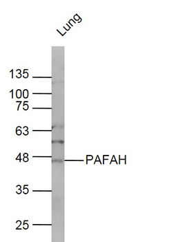 PLA2G7 Rabbit Polyclonal Antibody