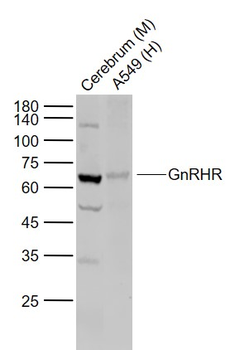 GnRHR Rabbit Polyclonal Antibody