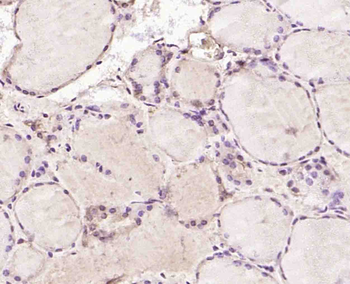 LIS1 Rabbit Polyclonal Antibody