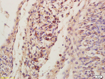 LIS1 Rabbit Polyclonal Antibody
