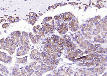 Liver FABP Rabbit Polyclonal Antibody