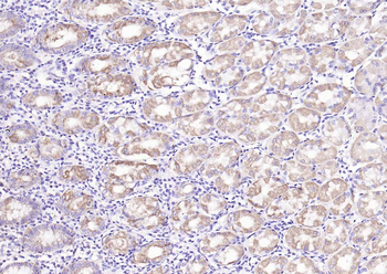 Liver FABP Rabbit Polyclonal Antibody