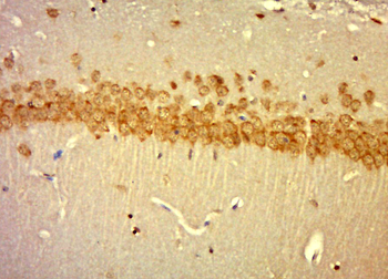 Laminin subunit beta-1 Rabbit Polyclonal Antibody
