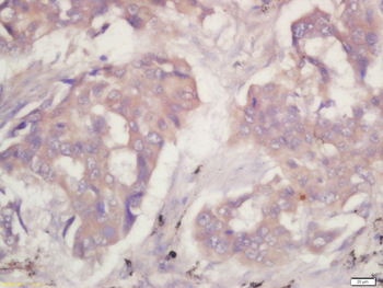 PKM2 Rabbit Polyclonal Antibody
